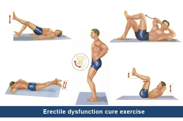 Erectile dysfunction cure exercise