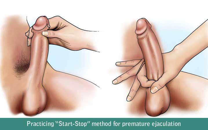 Practicing “Start-Stop” method for premature ejaculation
