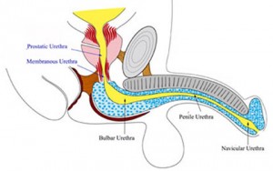 Urethral stricture disease