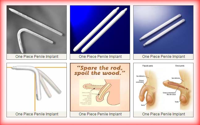 types of penile prostheses