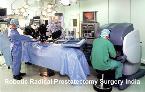 robotic radical prostatectomy surgery india