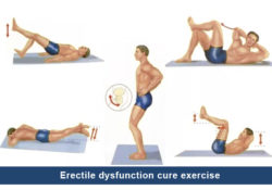 Erectile dysfunction cure exercise