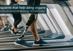 Transplants that help ailing organs - MIRACLES OF MODERN MEDICAL TECHNOLOGY
