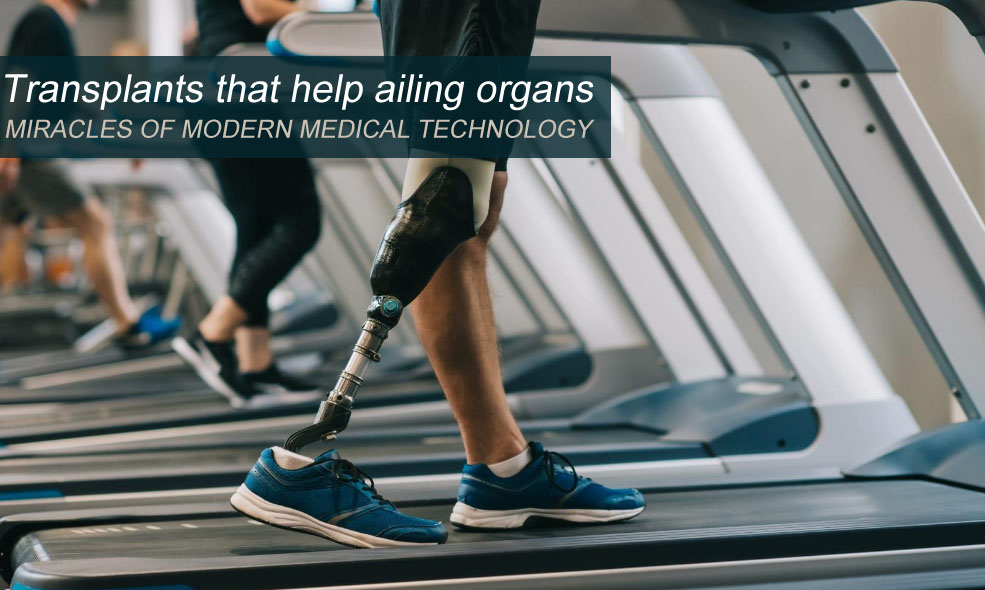 Transplants that help ailing organs